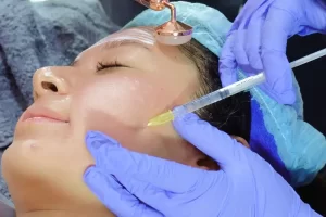 Skin Boosters